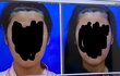 ++) 진심으로 안면윤곽 하고싶은데..(사진있음