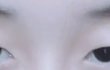 나 쌍커풀 전후차좀 봐줘