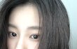 나 성형 시술 거의 다해봄 질문 ㄱㄱ