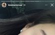아니 내 피부 왜이럼 개당황스러워