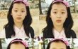 연예인성형전