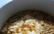 엉덩이에서 머리카락이 나와