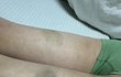 "초등교사 돼서는 안 될 인물"..'아동폭력'일삼은교사  자격 박탈 청원  쇠파이프 재질로 때렷다네요.조사받고나왓습니다. 교육청 공론화시켜서.교사자질이없는. 폭력행사한교사는.교사직권을 해지하고. 처벌받길