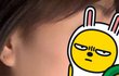 [사진첨부]침샘보톡스 맞을까요?