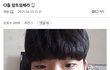 앞트임하면 진짜 이케됨??
