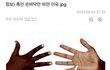 흑인 손바닥이 하얀 이유
