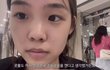 이 사람 코수술 개잘되지 않았냐