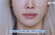 유튜버 뷰티기기 공구하는데 피부에 멍있음