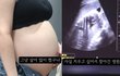 36주 낙태 유튜브 영상, '사실'… 유튜버 및 집도의 살인혐의 입건