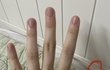 아니 야 나 이거 조현병인가 급함