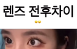렌즈 전후 차이 이렇게 심한 사람?