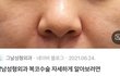 여자애들은 이 코가 ㅈㄴ많음ㅋㅋㅋㅋㄹㅇ
