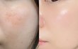 나 피부 많이 좋아지지않았어 ??