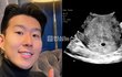 손흥민 진술서 내용 떴다 ㄷㄷ 만난 건 인정했는데 그 뒤가 충격 임신알고 만나자했는데 여자가 거절하고  돈요구 ㄷ