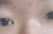 제 눈 성형 하려고합니다.. 욕 절대 xxxx이렇게 될 수 있을까요