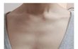 고민인데 새가슴필러 에바같음?
