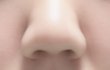 코성형 고민