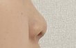 나 코수술했는데 질문받