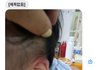 어린이집 시간제 보육을 맡겼는데 두개골 골절이 됐습니다..