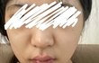 팔자주름있는 애들아 살빼