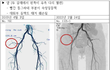 사이코 의사에게 당했습니다.
