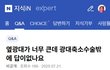 성형외과 의사들말 이제 못믿겠음..