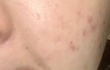 아니 이제 겨울이야?? 겨울철 피부관리 다들 어떻게해?