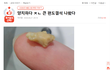 양치하다 ㅈㄴ 큰 편도결석 나왔다