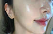 팔자주름 때문에 외모 정병 개심하게 왔는데