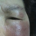 화진화장품 부작용.. 어쩜!! 이리도 심하게!!