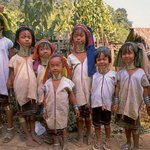 여드름없애는방법