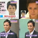 일본 남자 성형 <b>before</b> &amp; after.. 두렵다;;;;