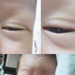 80일된 저의 아기 살려주세요