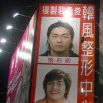성형 <b>최강</b> 중국