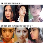 미녀 스타들의 점은 <b>자연산</b> vs 인공산