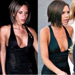 빅토리아 베컴, 가슴 <b>축소</b> 성형이 의심돼?