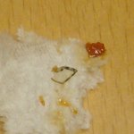 페<b>xxx</b> 치킨....벌레와 함께 버무려주네