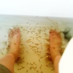 여자친구 <b>무좀</b>과 냄새를 어찌해야 할까요??