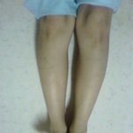 제 종아리가 그렇게 두꺼운가요??ㅜㅜ