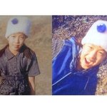 보아 성형?