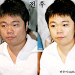 <b>정종철</b>이 성형을