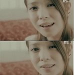 보아 <b>쌍</b>커플 수술한건가.....?