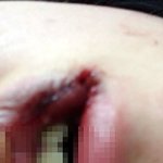 동생을 때린 상습적인 폭행남친 어떻게 해야될까요?