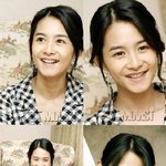 님들아~ <b>이</b> 병원에서는 강혜정 <b>수술</b>후가 더 예쁘다고 하네요