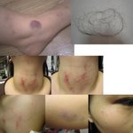 시부모에게폭행과 살인<b>미수</b>를 겪었는데 어떡해야합니까