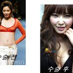 김새롬 가슴<b>수술</b> <b>전</b>&amp;후