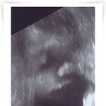 <b>뱃속</b>에 있는 우리 아기 얼굴 알아보시겠어요??