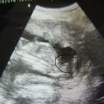 기분 좋아서 들어왔어요..... ^^;;