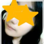 전성형하고 싶어서 미친것같아요 (사진첨부)