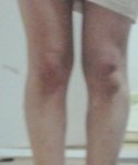 제다리많이못생겼나요?(<b>사진</b>有)